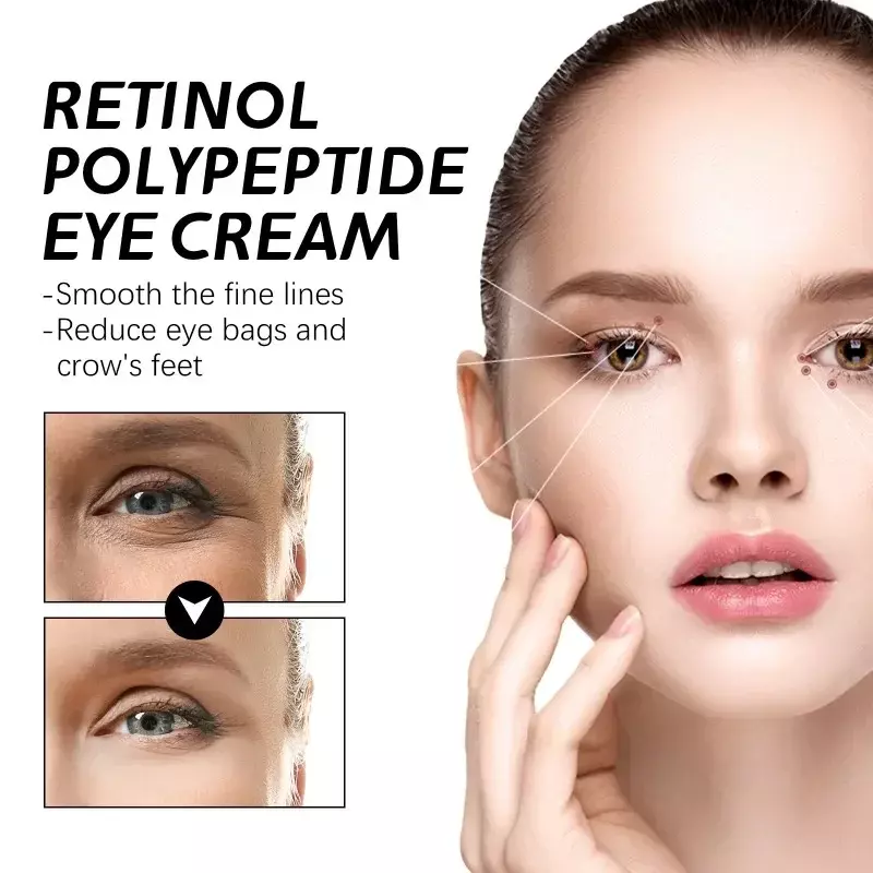 كريم للعين من Sdatter-Retinol ببتيد الريتينول ، خطوط دقيقة متلاشية ، دوائر داكنة ، أكياس للعين ، إزالة التجاعيد ، مكافحة الشيخوخة ، الترطيب ، إصلاح البشرة #1