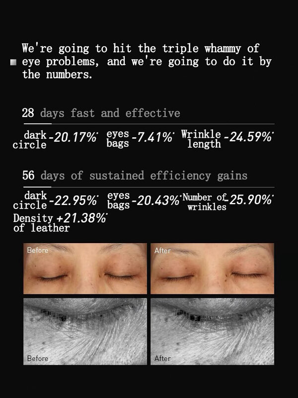 كريم العين بدون آثار جانبية ، إزالة الحقيبة ، الهالات السوداء ، الانتفاخ ، الخطوط الدقيقة ، العيون