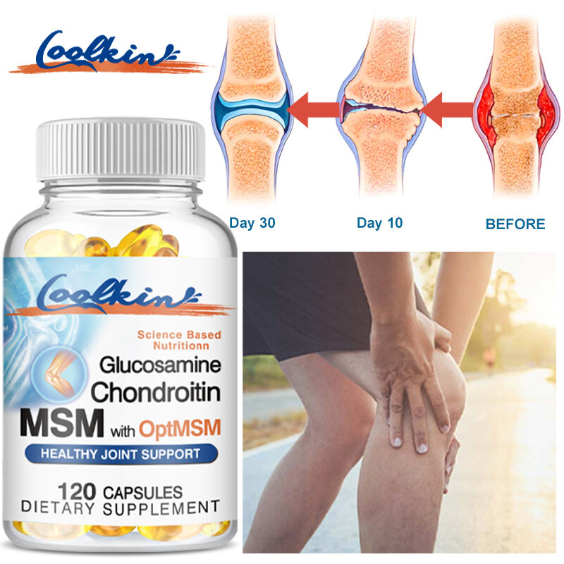 الجلوكوزامين شوندرويتين MSM و Optimsm ، يعزز الجلد والأظافر وصحة المفاصل