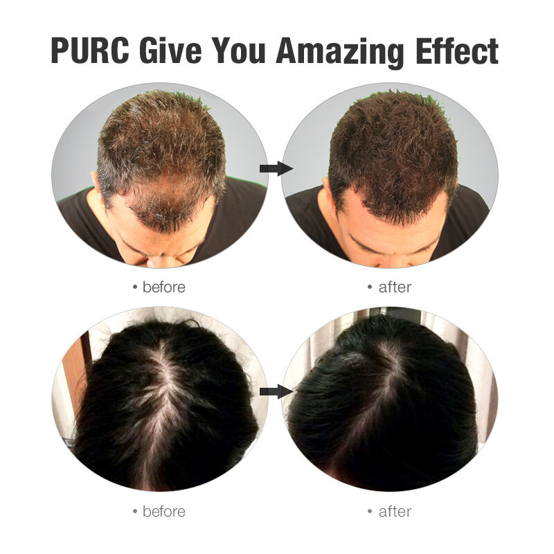 PURC سريع نمو الشعر الشامبو مكيف مثخن مكافحة فقدان الشعر تنمو الشامبو مجموعة علاجات فروة الرأس منتجات العناية بالشعر 600 مللي