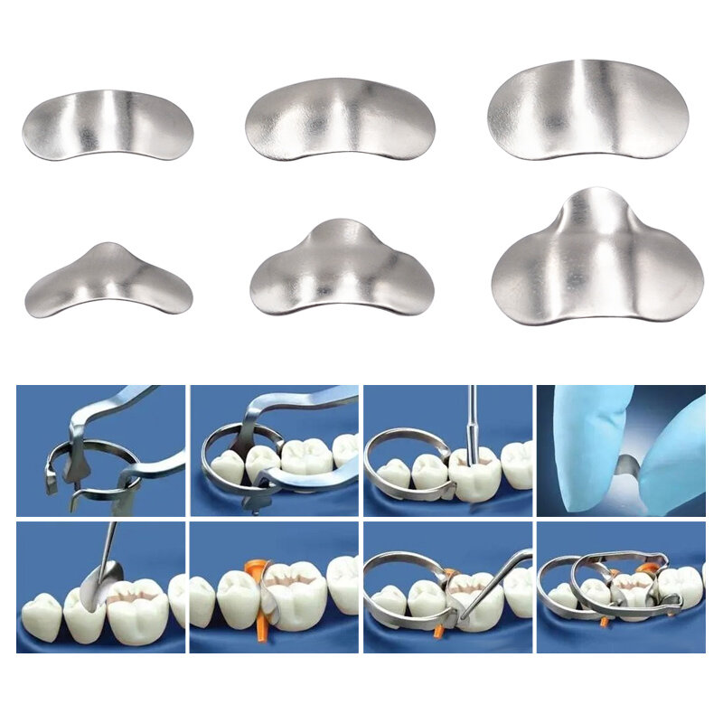 Denspay 100 قطعة الأسنان الاقسام مصفوفة نظام الأسنان الاقسام مصفوفة الفرقة الراتنج لقط فصل حلقة أدوات طبيب الأسنان