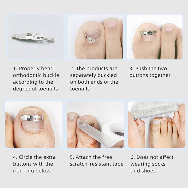 أدوات مصحح أظافر نام ، استعادة باديكير ، تضمين علاج أظافر الأصابع ، أداة تصحيح العناية بالقدم المهنية ، 1 Set