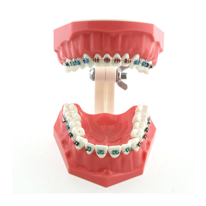 نموذج تقويم الأسنان Typodont مع أقواس معدنية ، دعامة أسنان