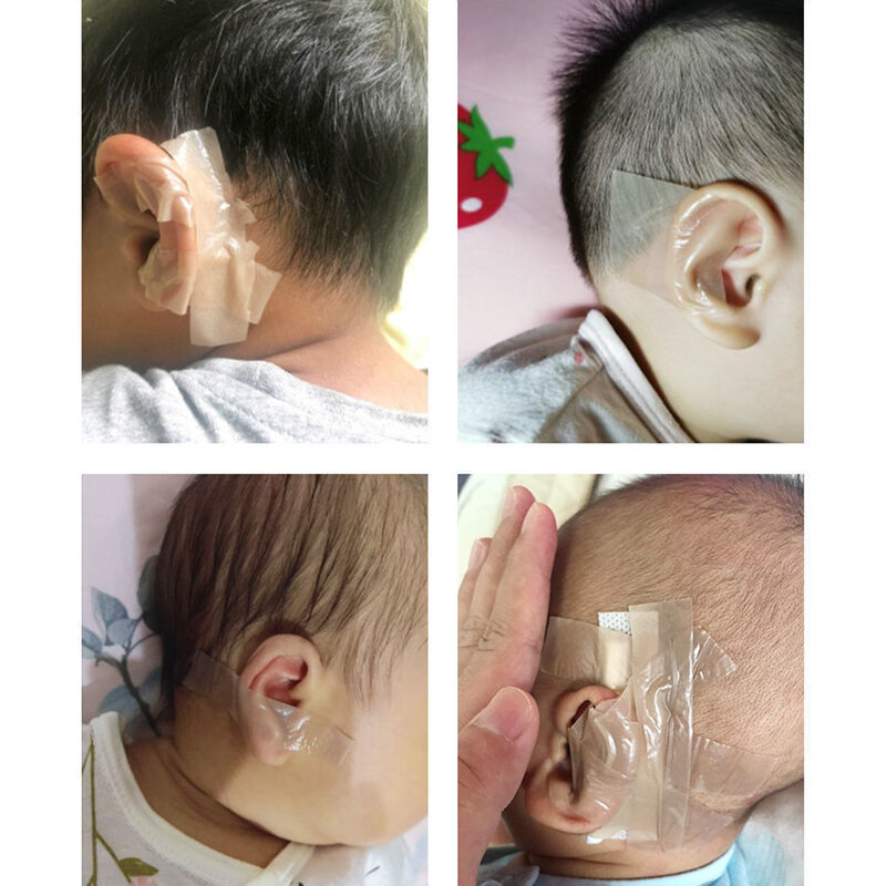 جديد الأذن تصحيح الشريط أداة تنظيف الأذن عدة الوليد الطفل الأذن الجمالية مصحح الاطفال الرضع جاحظ ملصقات الأذن التصحيح