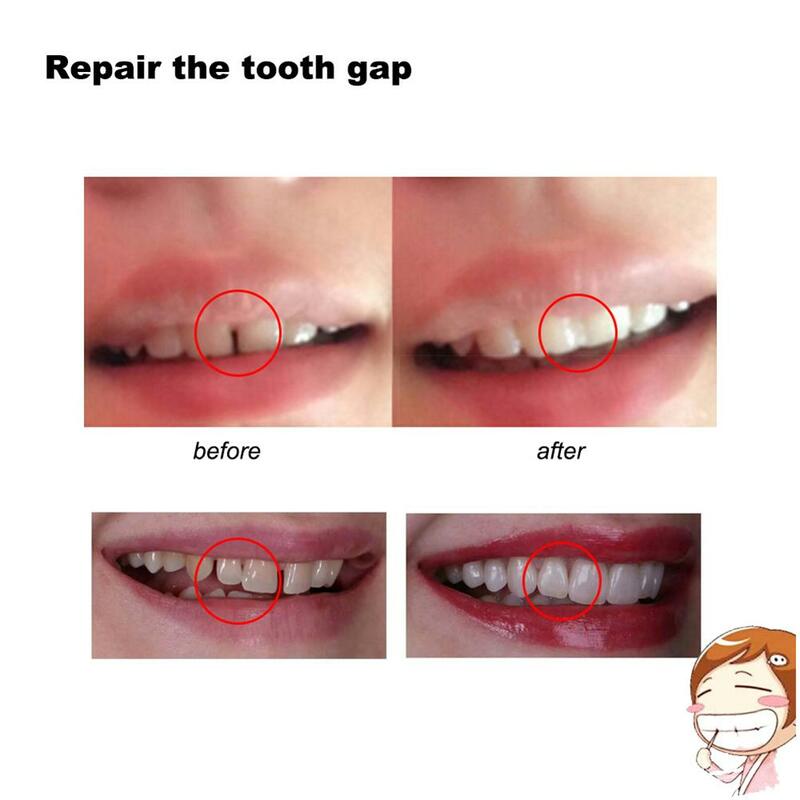 10g/100g أسنان الصلبة الغراء إصلاح الأسنان طقم تصليح الأسنان المؤقتة أداة العناية بالفم إصلاح الأسنان المؤقتة