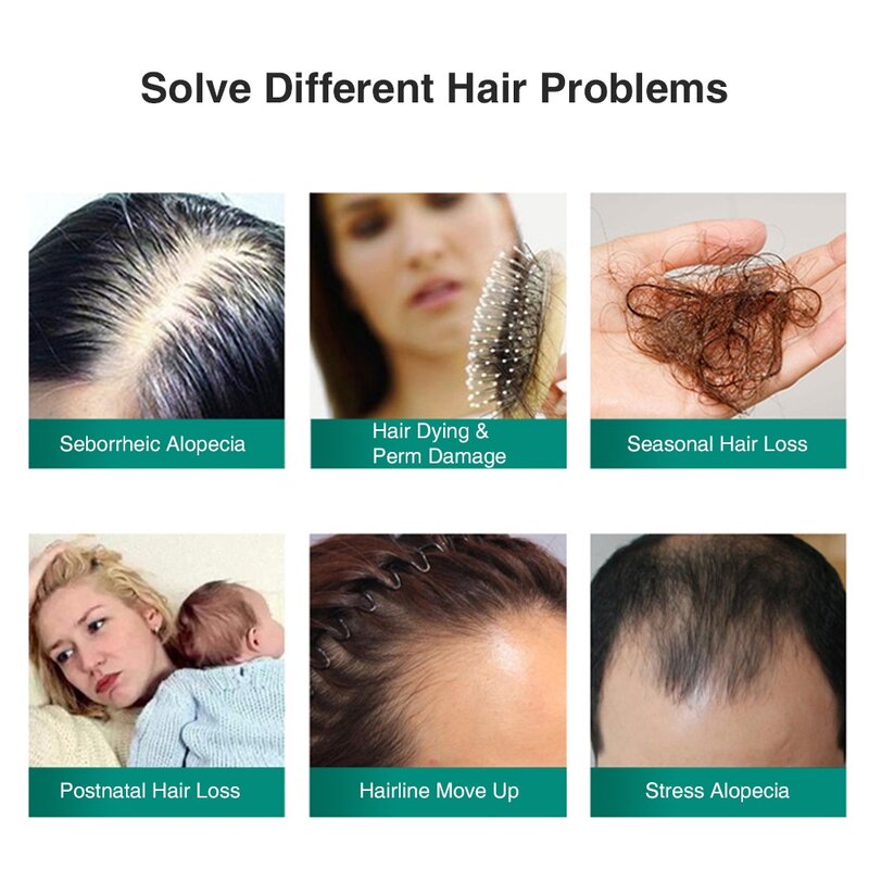 جديد الزنجبيل نمو الشعر الضروري رذاذ مكافحة فقدان الشعر المصل 7 أيام فعالة إصلاح الجراثيم تزايد العلاج السائل الرجال النساء