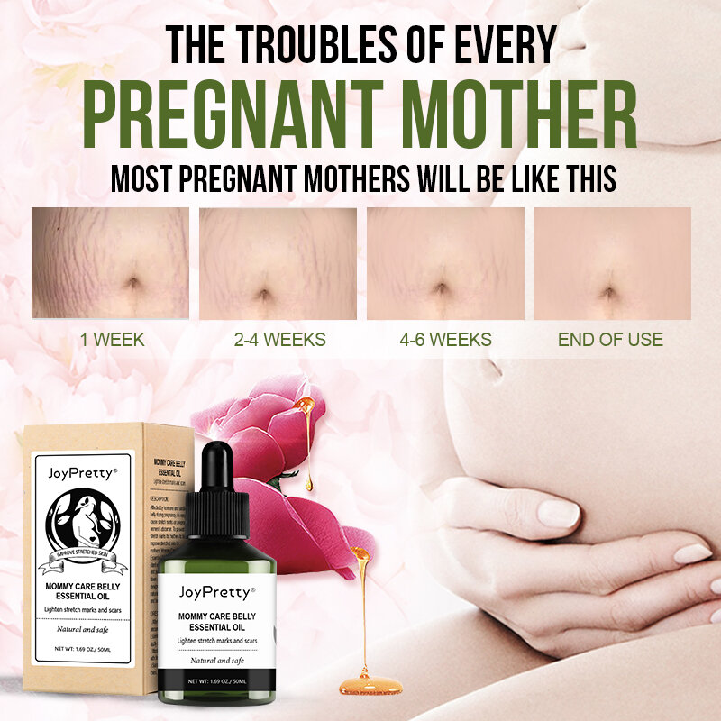 JoyPretty الأمومة تمتد علامات مزيل النفط الحمل الجسم العناية بالبشرة زيت طبيعي تمتد علامة كريم إزالة العلاج 50 مللي