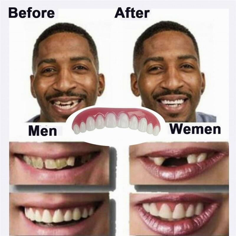أسنان مثالية لحظة ابتسامة القشرة مستحضرات التجميل الأسنان القشرة أطقم الأسنان سيليكون العلوي/السفلي كاذبة للمرأة والرجل مريحة