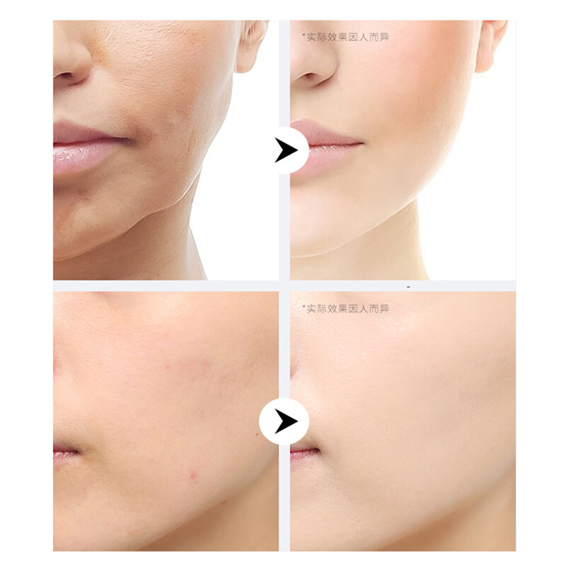 فولرين تبييض ترطيب جوهر المضادة للأكسدة تحسين Dullness جوهر الوجه حتى الجلد لهجة اشراق الجلد مصل الوجه