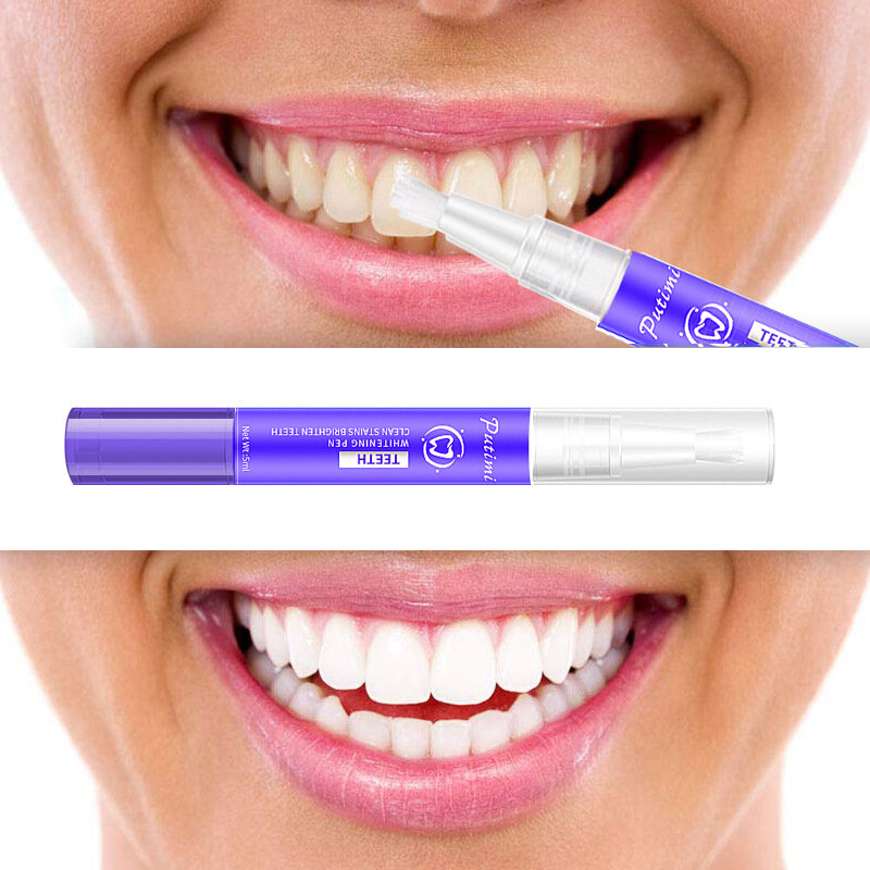 5 مللي قلم تبييض الأسنان سيرم تنظيف البلاك والبقع مزيل تبييض الأسنان مبيض الأسنان العناية بصحة الفم مبيض الأسنان