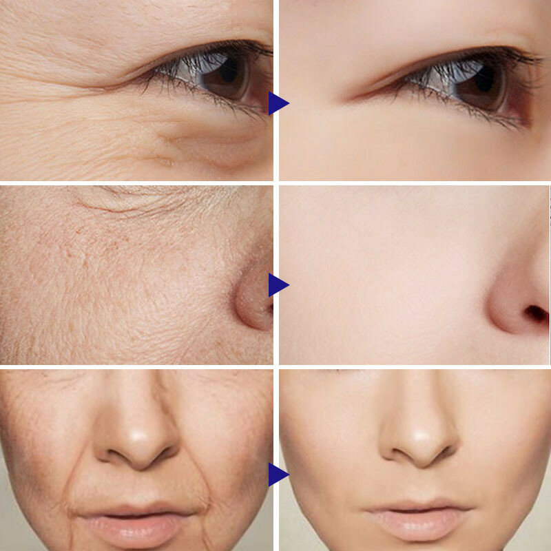 فيتامين ج حمض الوجه مصل مكافحة الشيخوخة المضادة للتجاعيد جوهر تبييض ترطيب التقشير تقليص المسام تتلاشى الخطوط الدقيقة الرعاية