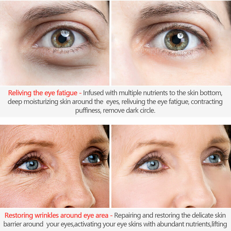LANBENA فيتامين C العين جوهر إزالة الهالات السوداء تبييض العين مصل مكافحة الشيخوخة تحسين الانتفاخ التجاعيد العناية بالعين مرطب