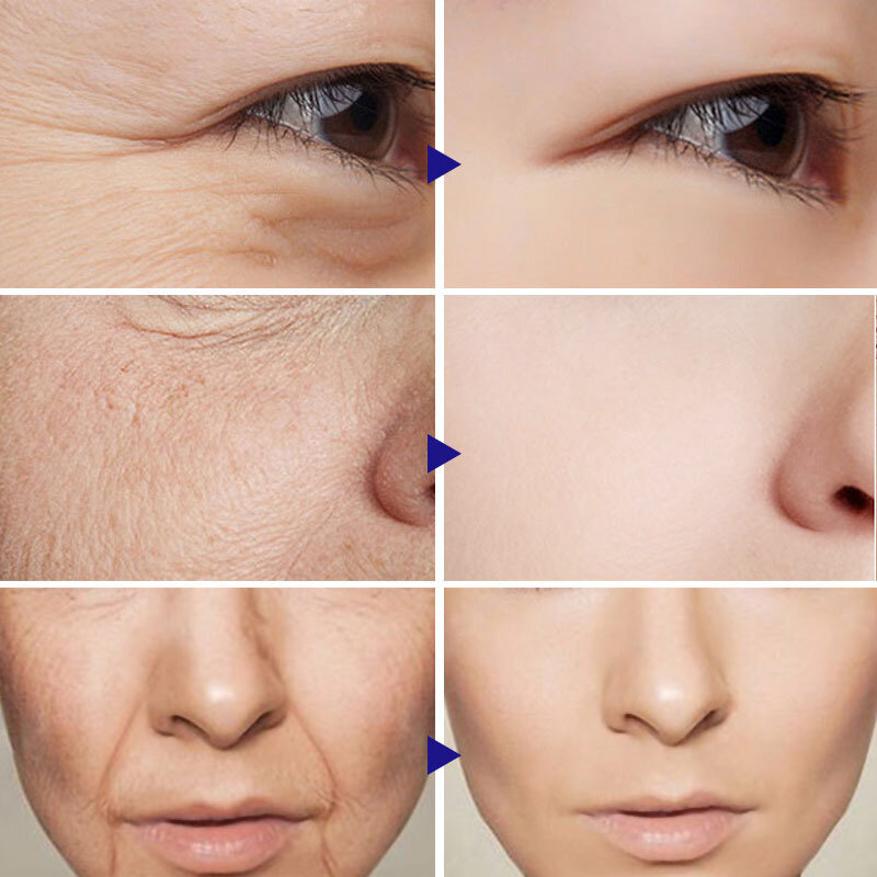 فيتامين ج حمض الهيالورونيك مصل الوجه النقي 100% قوي مكافحة الشيخوخة التجاعيد شد الجلد يغذي السلس جهاز العناية بالوجه