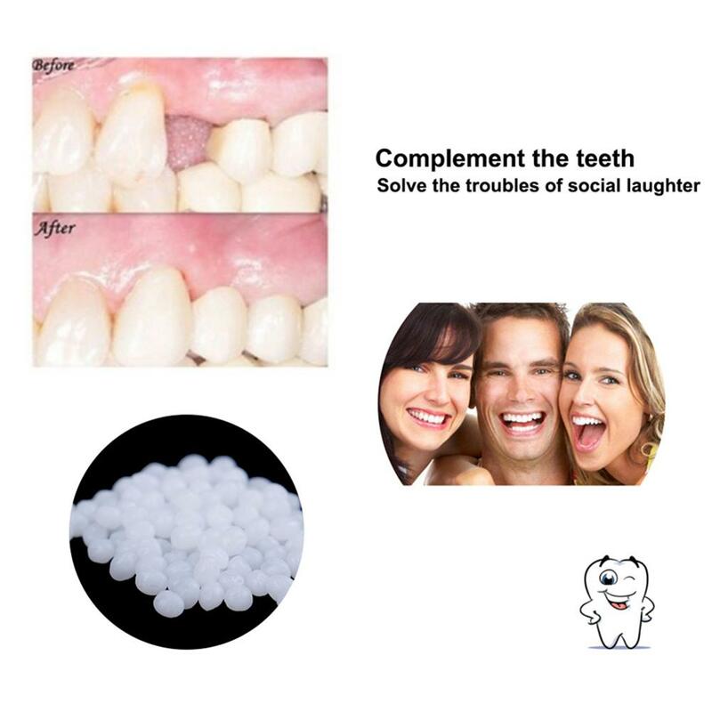 10g/100g أسنان الصلبة الغراء إصلاح الأسنان طقم تصليح الأسنان المؤقتة أداة العناية بالفم إصلاح الأسنان المؤقتة