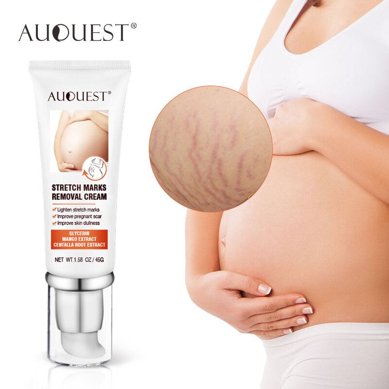 AuQuest تمتد علامات مزيل كريم للجسم العناية بالبشرة الأمومة كريم ل تمتد علامة العلاج إزالة الحوامل ثبات العناية بالبشرة