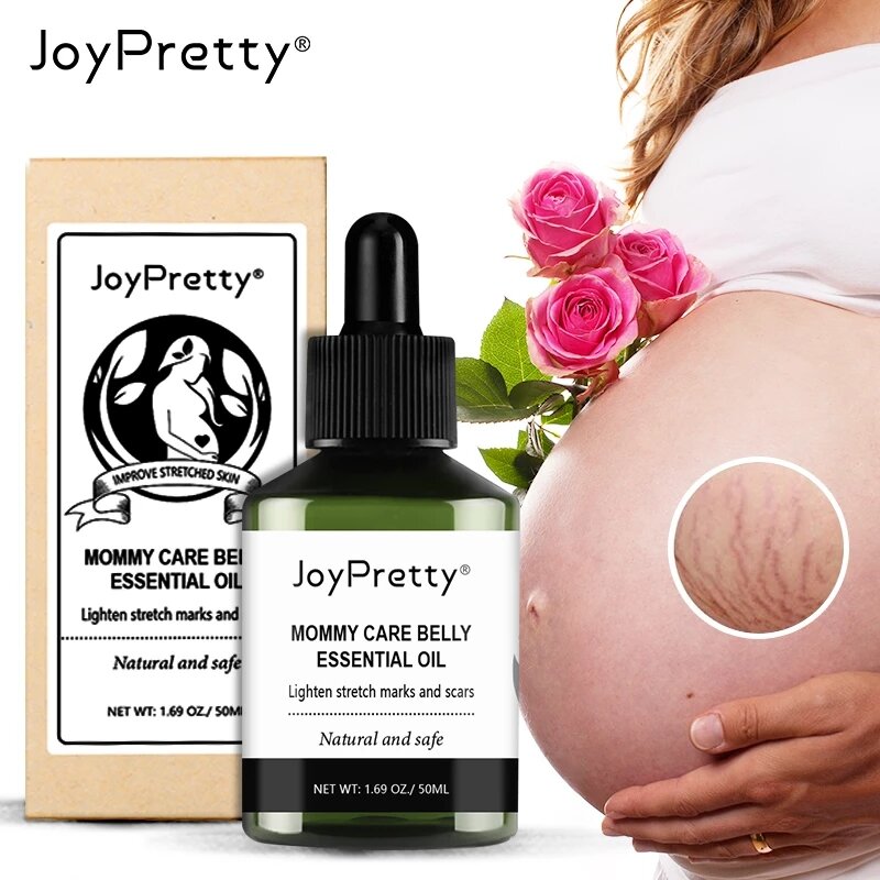 JoyPretty الأمومة تمتد علامات مزيل النفط الحمل الجسم العناية بالبشرة زيت طبيعي تمتد علامة كريم إزالة العلاج 50 مللي