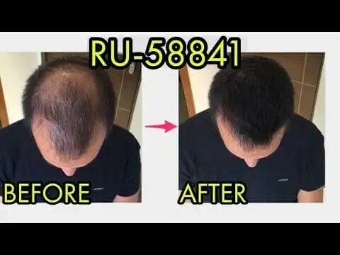 حل تساقط الشعر ru58841 مسحوق 154992-24-2 زائد 99 في المئة نقاء