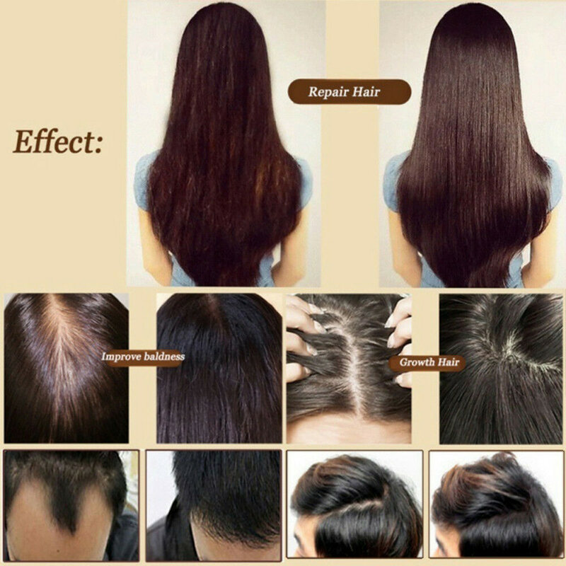الزنجبيل زيت إنبات الشعر العناية بالشعر صحية مغذية مكافحة تساقط الشعر العلاج سريع كثيف إعادة نمو الزنجبيل المصل 30 مللي