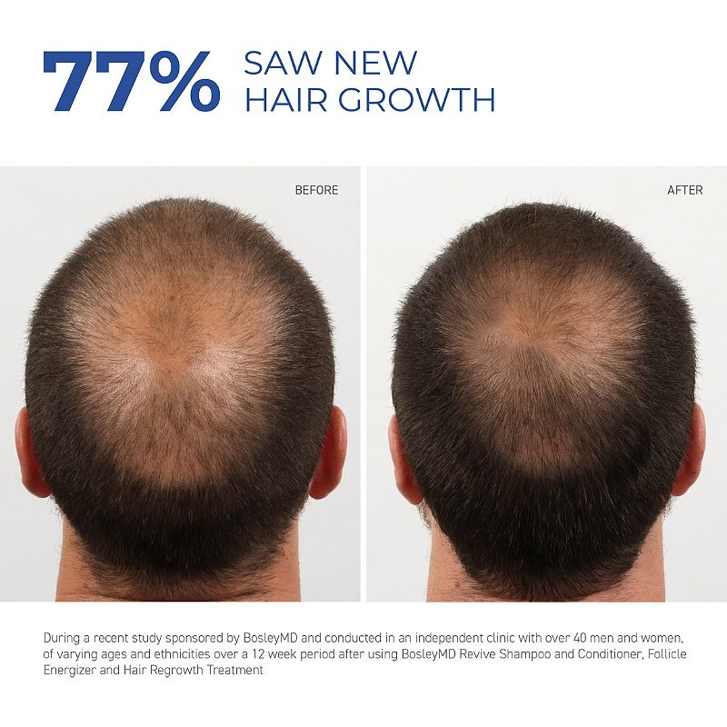 نمو الشعر جوهر الطبيعية العشبية العلاج الصحي تساقط الشعر يجعل نمو الشعر أطول وأكثر سمكا منتجات العناية بالشعر (10-60 مللي)