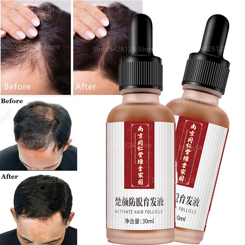 Hair Nutrient Liquid Hair Growth Serum Nourishes Dense Hair Fast Hair Growth Prevention Hair Loss Men's and Women's Products