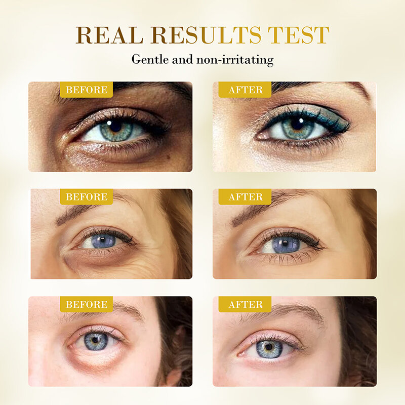 AuQuest 80 قطعة بقع العين 24K قناع العين الذهبي الانتفاخ والدوائر السوداء العلاجات تقليل التجاعيد مكافحة الشيخوخة ترطيب تبييض