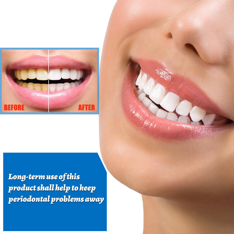 إيلهو تبييض الأسنان جوهر السائل نظافة الفم تنظيف تبييض الأسنان مصل إزالة البلاك البقع تبييض العناية بالأسنان 10 مللي