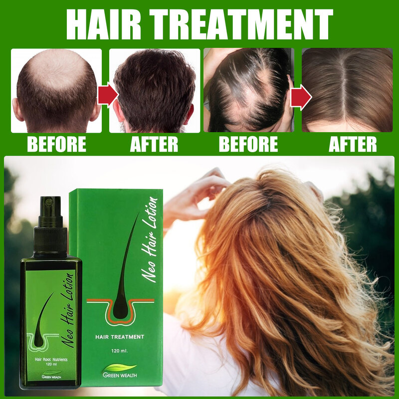 Thailand Original 120ml Neo Hair Growth Oil Hair Lotion Thailand Massage Liquid Fast Growing Germinal Anti-loss Treatment Serum