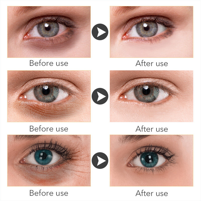 إزالة الهالات السوداء كريم عين فيتامين C سطع مصل مكافحة الانتفاخ المضادة للتجاعيد ثبات إصلاح عيون مستحضرات التجميل للعناية بالبشرة 20 جرام