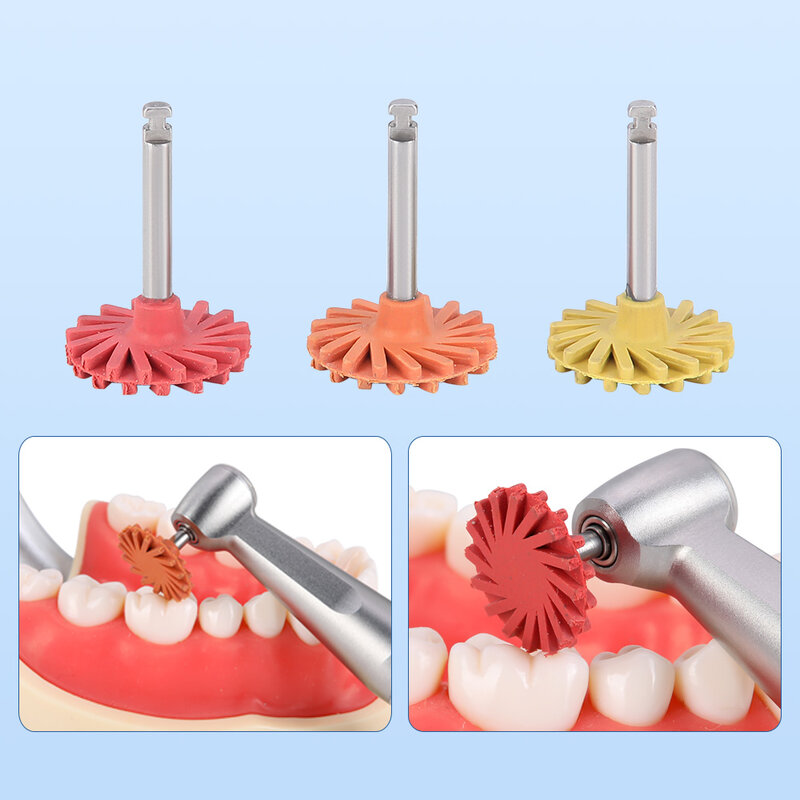 JOY الأسنان-الأسنان مركب تلميع القرص عجلة عدة ، دوارة طحن وتلميع الأدوات ، الخشنة ، متوسطة ، غرامة ، 6 قطعة