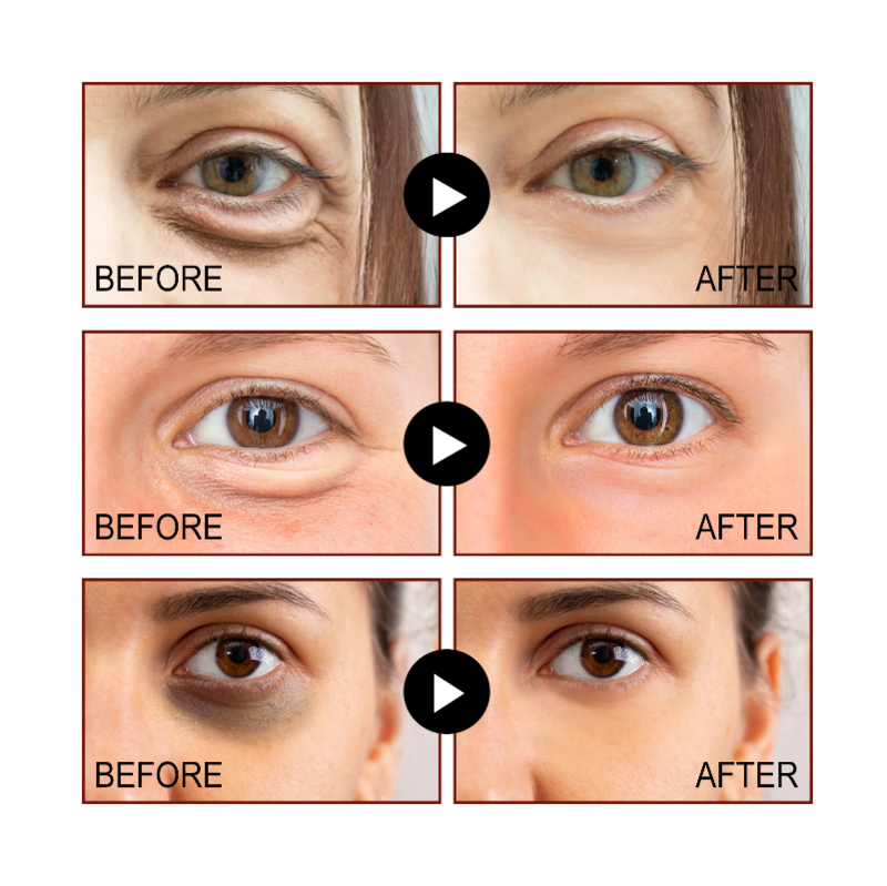 كريم العين يتلاشى الخطوط الدقيقة إزالة أكياس العين يحسن الهالات السوداء المضادة للتجاعيد الشيخوخة ترطيب رفع ثبات العين العناية بالبشرة