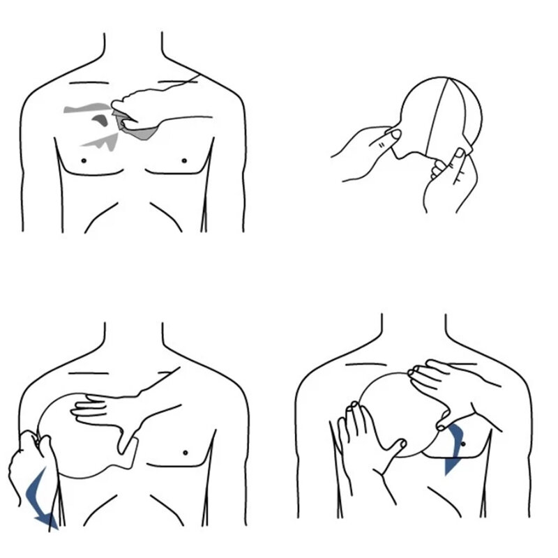 الصدر ختم الطبية الصدر ختم تنفيس الصدر الجرح لفتح الصدر إصابة لاصقة خلع الملابس